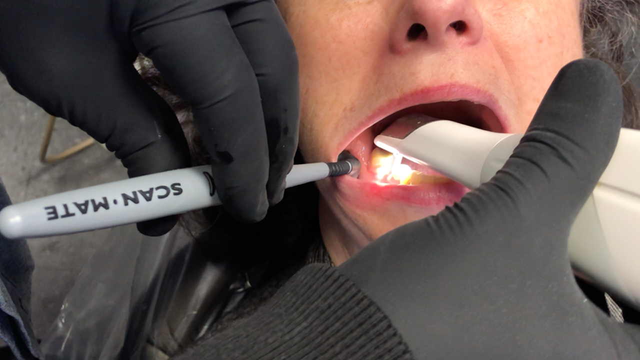 Scan Mate® Professional – Armor Dental
